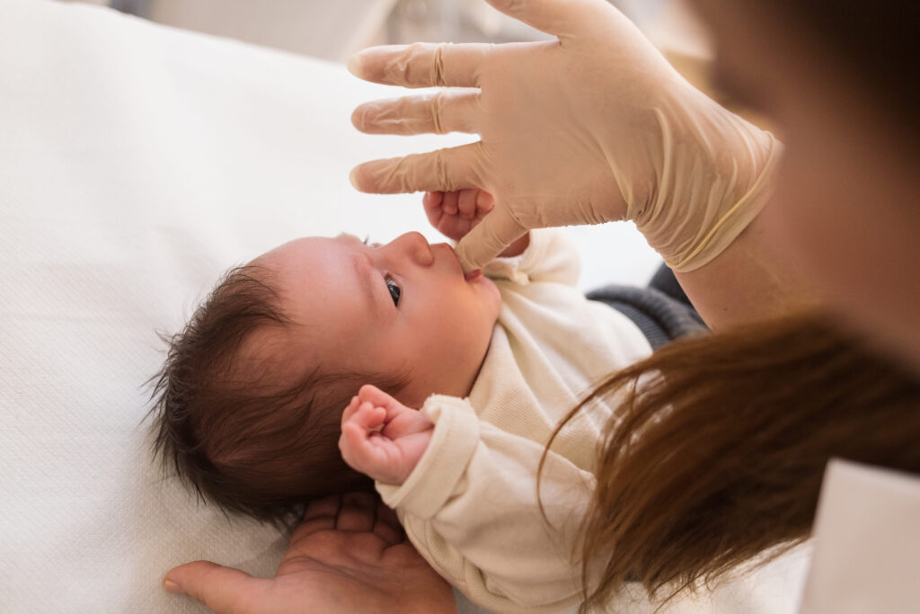 deglutizione atipica nei neonati